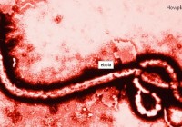 First Ebola Patient of Pakistan Die in Faisalabad [howpk.com]