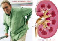 5 ways to cure kidney disease naturally [howpk.com]